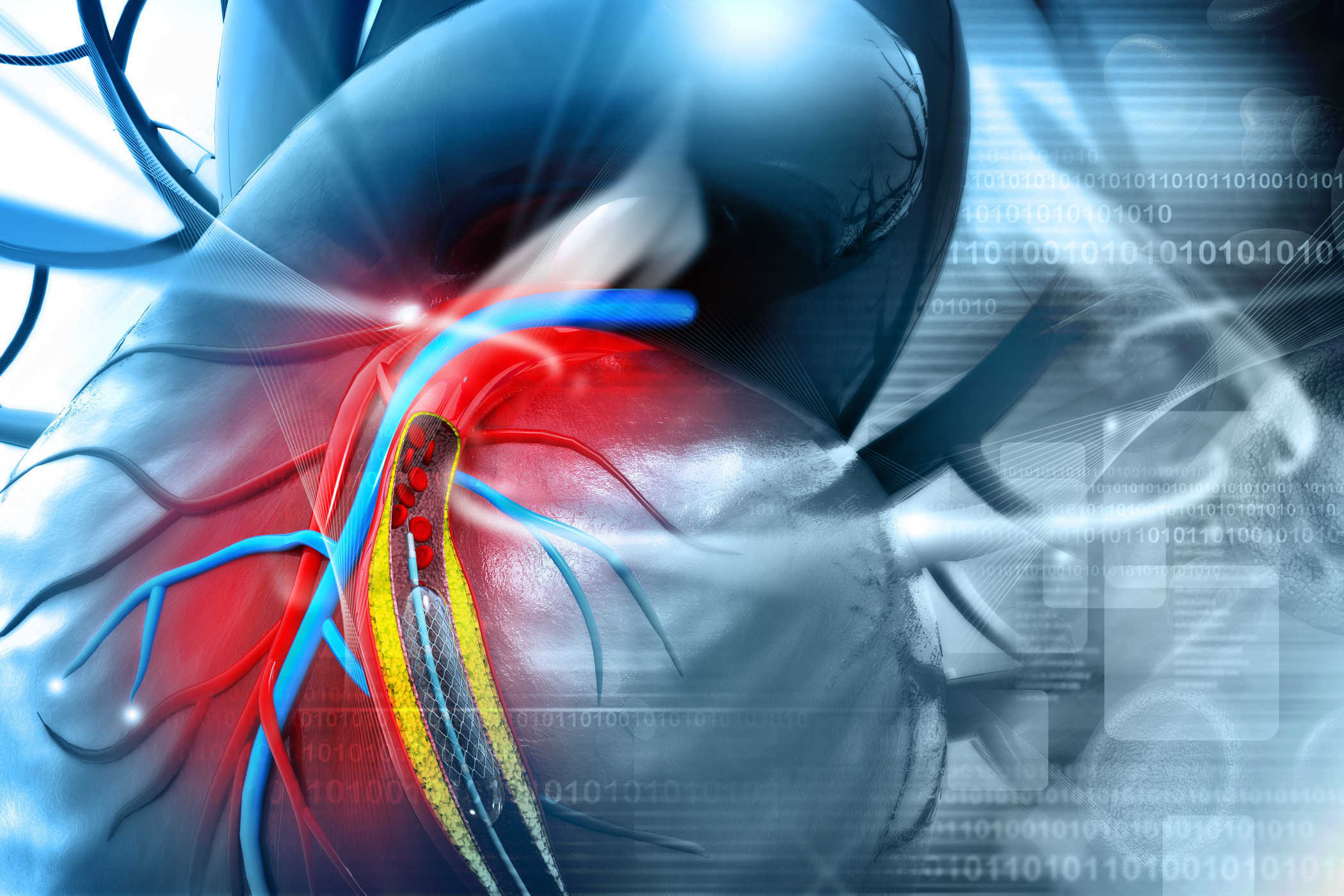 CORONARY HEART DISEASE (THE BASICS)