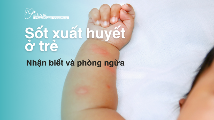 NHẬN BIẾT VÀ PHÒNG NGỪA SỐT XUẤT HUYẾT Ở TRẺ