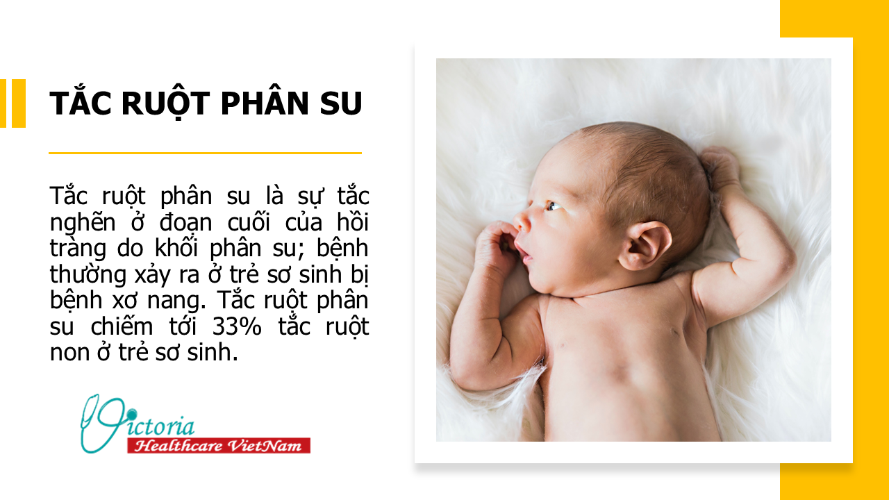TẮC RUỘT PHÂN SU