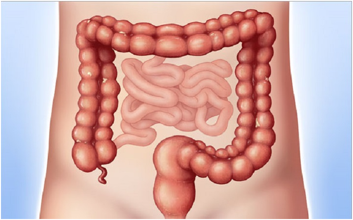 CANCER OF THE COLON AND RECTUM