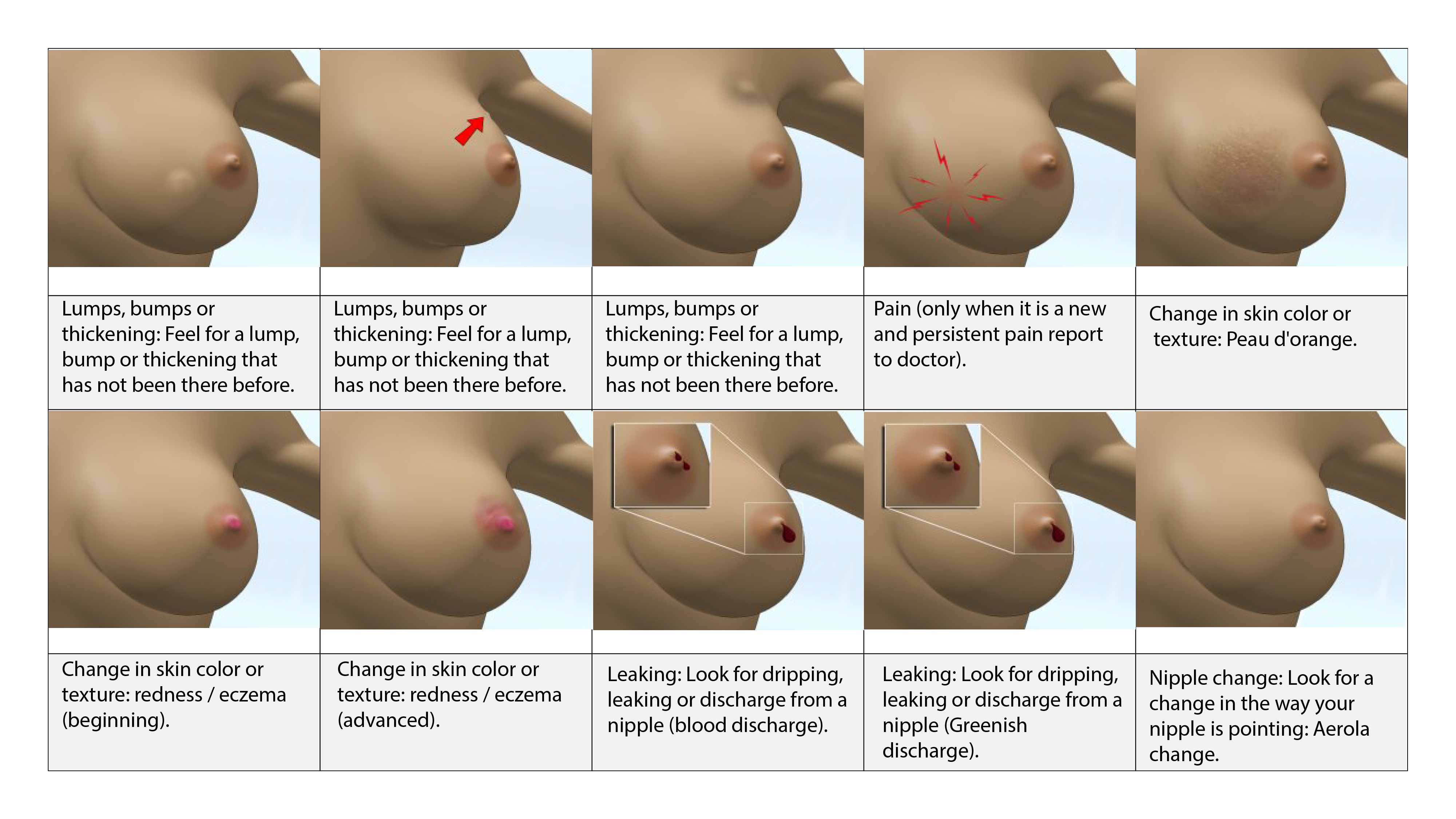 BREAST CANCER / BREAST SELF-EXAMINATION (BSE)