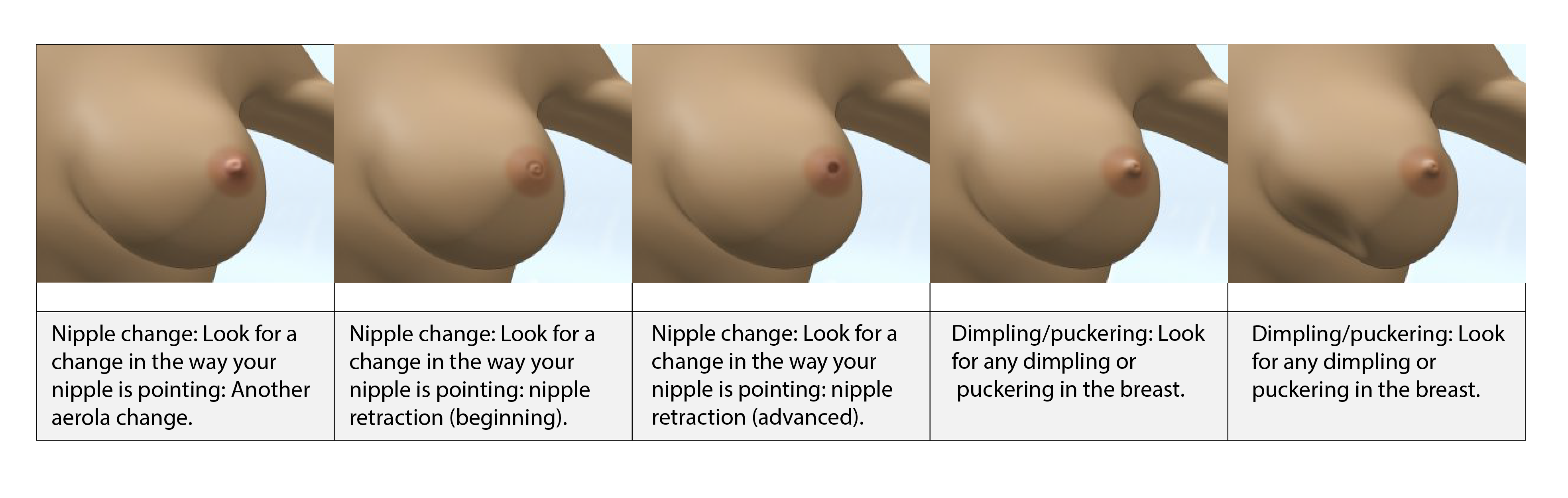 breast abnormally 02